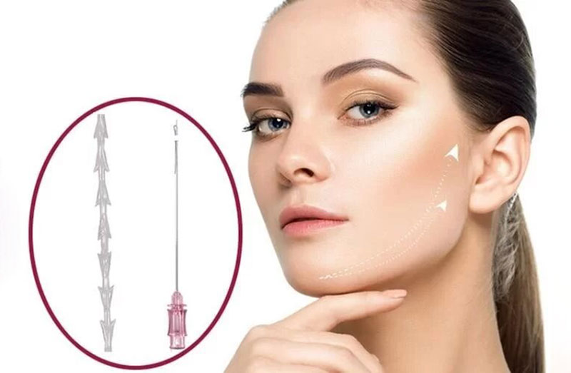 ریکاوری و مراقبت‌های بعد از لیفت با نخ