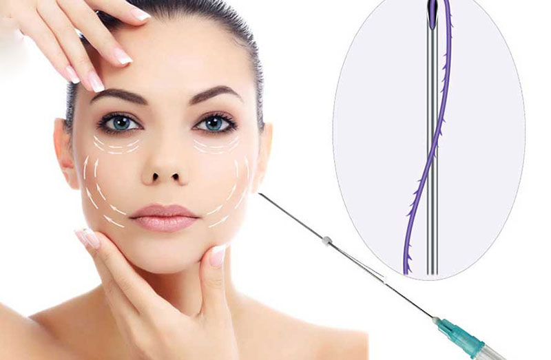کاربردهای لیفت با نخ خاردار